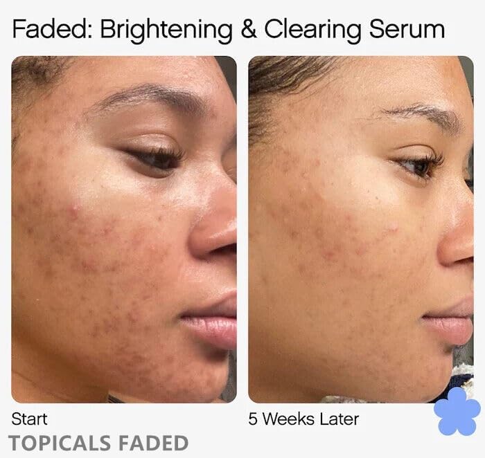 TOPICALS FADED Serum Vegan, Gluten-Free and Cruelty-Free