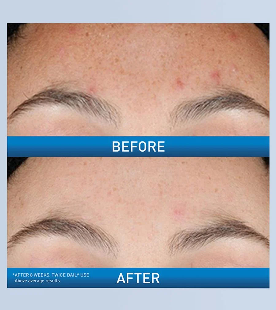 CeraVe Resurfacing Retinol Serum For Face with Niacinamide
