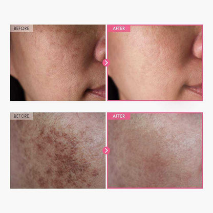 Tosowoong Moisturizer