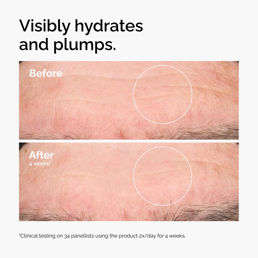 The Ordinary Hyaluronic Acid 2% + B5 (with Ceramides)