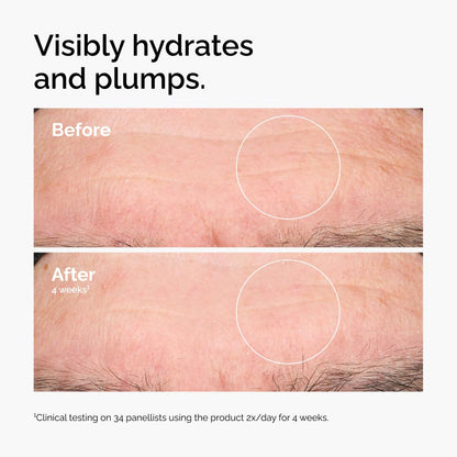 The Ordinary Hyaluronic Acid 2% + B5 (with Ceramides)