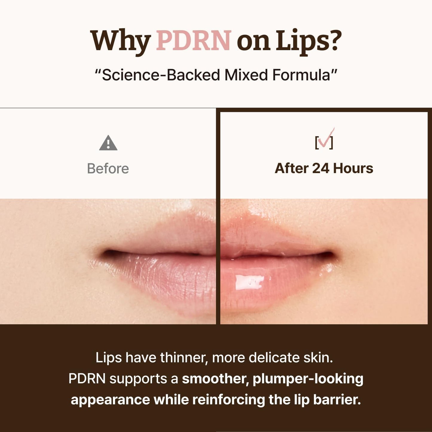Dr. Reju-All Advanced PDRN Rejuvenating Lip Serum