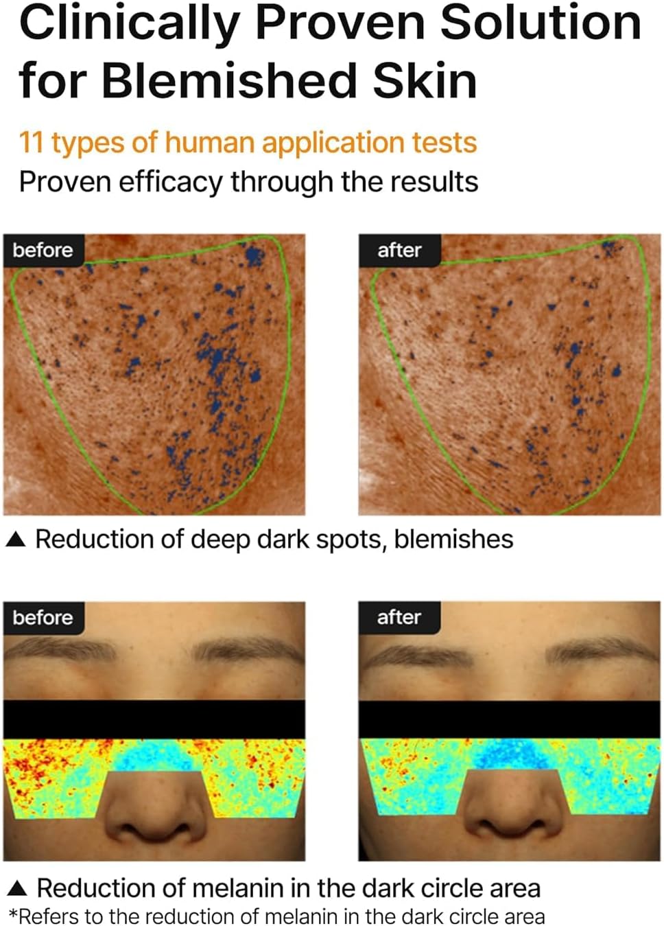 celimax Pore Dark Spot Brightening Cream