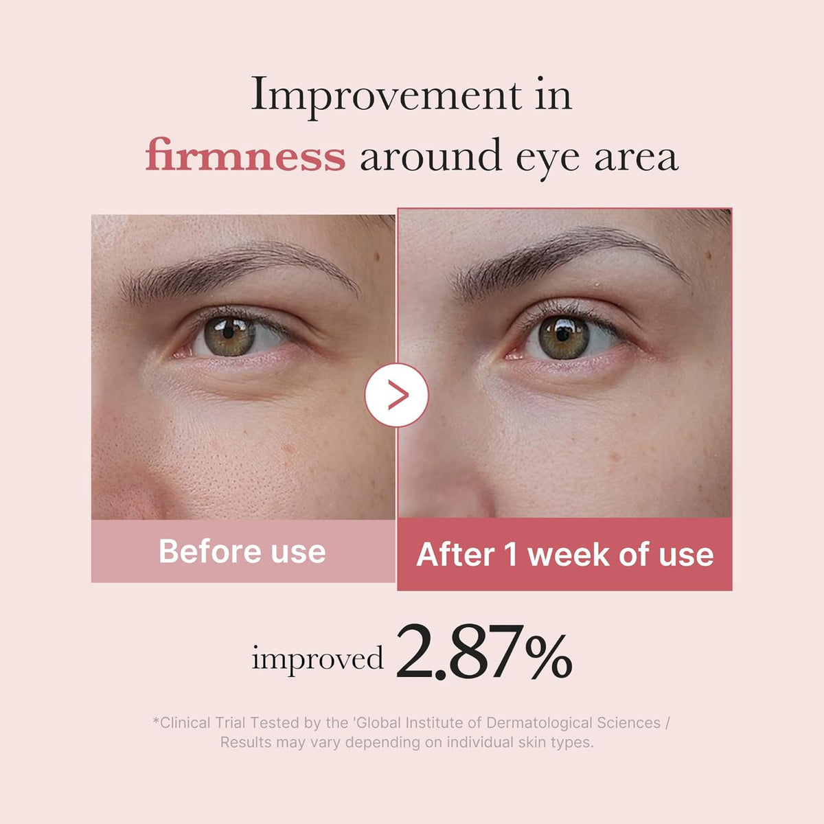 PDRN Pink Peptide Eye Cream  - 1.01 oz