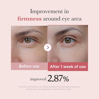 PDRN Pink Peptide Eye Cream  - 1.01 oz