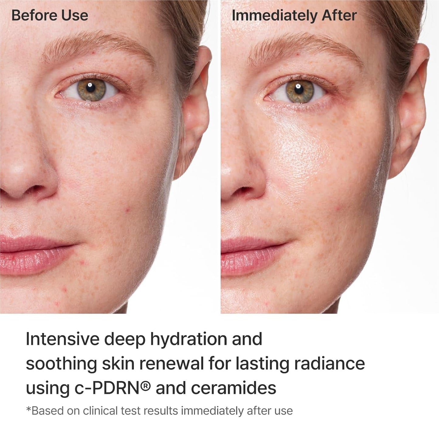 REJURAN® Turnover Mask, c-PDRN® (5ea) – Original Salmon DNA for Firming, Hydration, Repairing & Revitalizing.