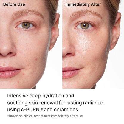 REJURAN® Turnover Mask, c-PDRN® (5ea) – Original Salmon DNA for Firming, Hydration, Repairing & Revitalizing.