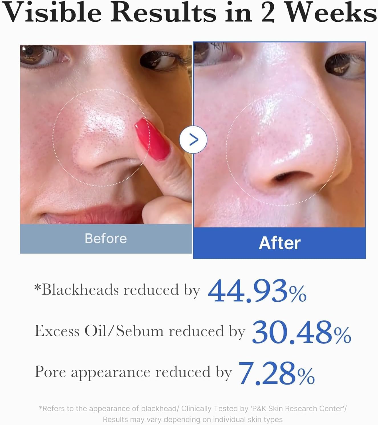 Medicube Zero Pore Pads 2.0