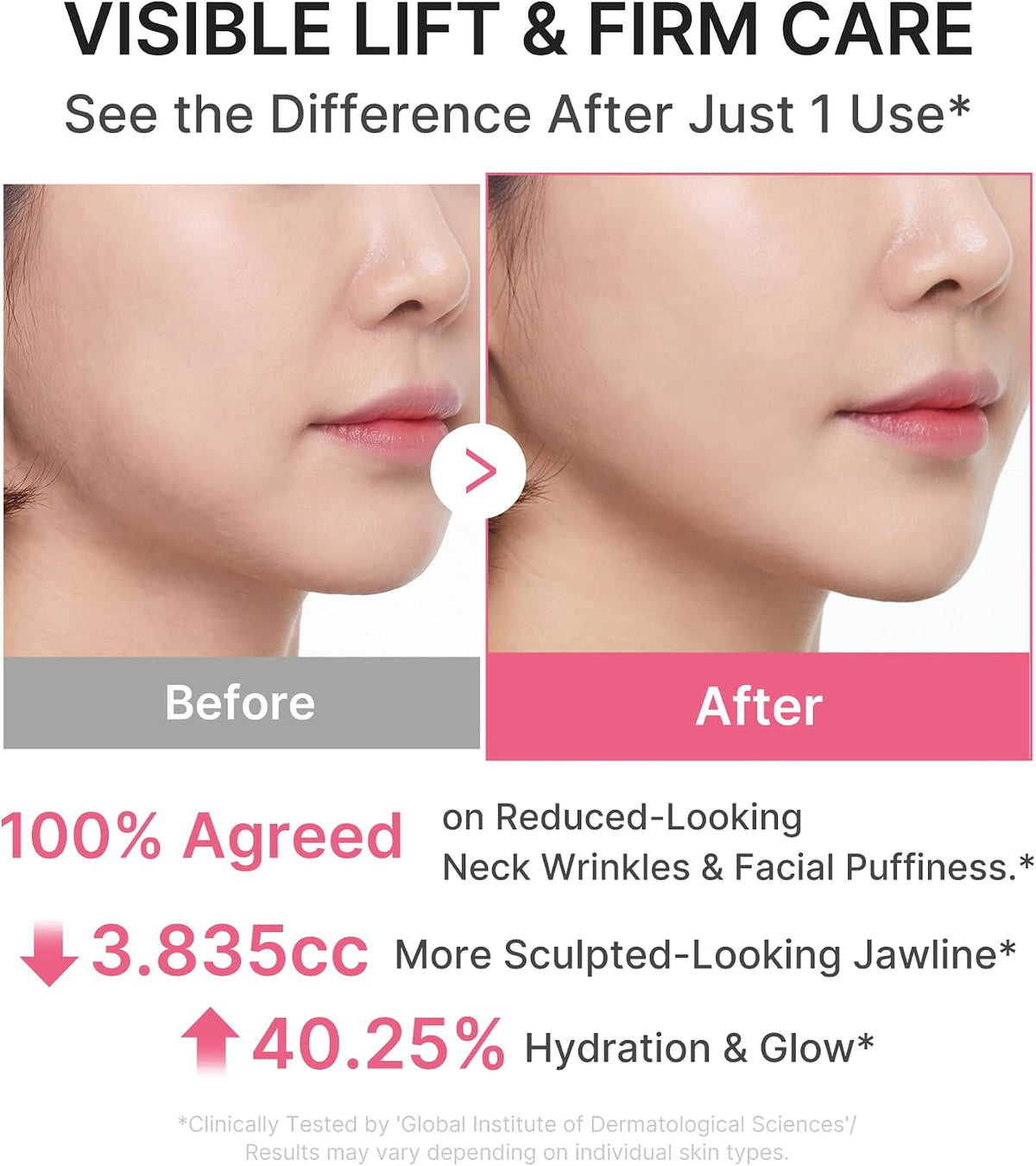 Medicube PDRN Collagen Gua Sha Neck Wrinkle Cream (90g)