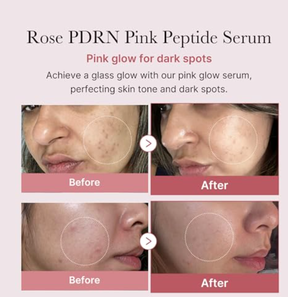 Medicube, PDRN Pink Peptide Serum , 1.01 fl oz (30 ml)